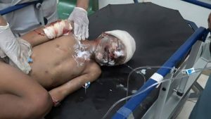 13880263_838413179629421_8201097443853348842_n