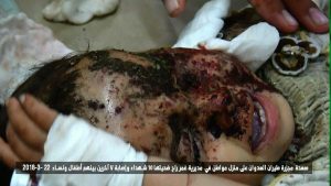 شاهد | غارات للعدوان تحصد أرواح 19 مدني بينهم نساء وأطفال في الحديدة وصعدة (صور)