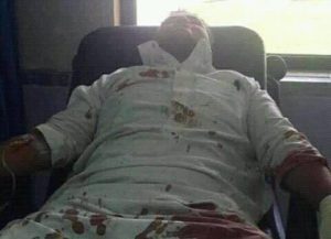 بالصورة..السلطات السعودية تقتل مغترب يمني وتُصيب ثلاثة آخرين