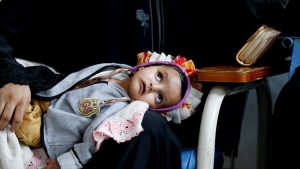 ارتفاع نسبة الإصابة بالسرطان في اليمن إلى 40 ألف حالة سنويا
