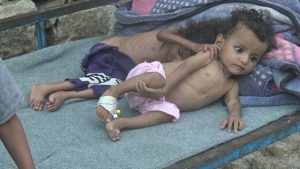 الصحة بمحافظة ريمة تترنح على أوجاع المرضى والمصابين بوباء الكوليرا (تحقيق مؤلم بالصور)