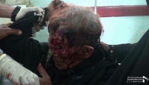 إصابة إمرأة مسنة في قصف جوي وبري سعودي على صعدة وحجة