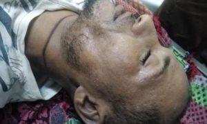 شاهد: طريقة إعدام وحشية بحق مواطن من أبناء تعز في عدن “والسبب”