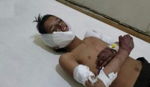 مقتل وإصابة ثلاثة آلاف و841 مدنيا جراء القنابل العنقودية في اليمن