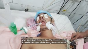 إصابة 4 مواطنين بقصف سعودي على صعدة