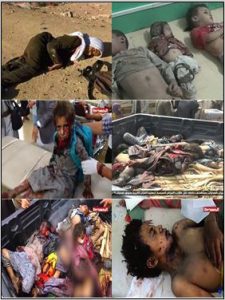 انتصاف: استشهادُ وإصابة 8 آلاف و218 طفلاً منذ بدء العدوان على اليمن