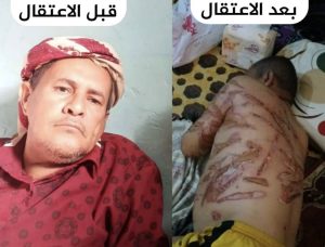 جريمة وحشية في أبين تهز اليمن (مشهد يقطع القلب)