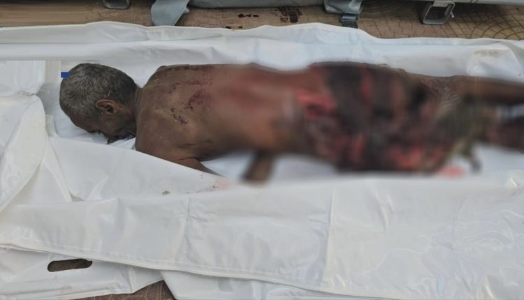 الجراحي 3