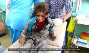 وزارة الصحة تعلن عن حصيلة ضحايا اليمن جراء العدوان خلال الشهر الجاري