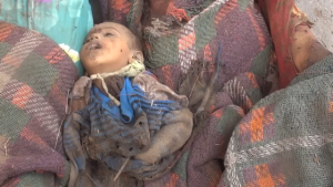 1400children have been killed in the ongoing deadly Saudi aggression  against Yemen