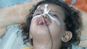 الاستجابة المميتة تحقيق استقصائي بالوثائق والشهادات يفضح جرم منظمة الصحة العالمية بحق مرضى الكلى في اليمن