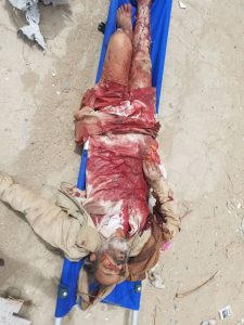 15 شهيد وجريح بغارة استهدفت بوابة المستشفى الريفي بسوق كتاف “الأسماء+صور”