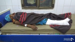 إصابة إمرأة و4 أطفال بعض جراحاتهم خطيرة بنيران المرتزقة جنوب الحديدة (صور)