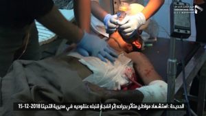 مواطن يموت بين أيدي الأطباء بعد عجزهم في إنقاذ حياته بالحديدة (شاهد الصور)