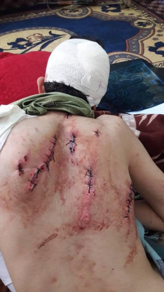 إصابة خطيرة لأحد قيادات المرتزقة بجبهة صرواح “شاهد الصور”
