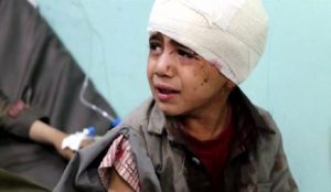 شاهد أممي .. الوضع في اليمن كارثي إلى درجة يصعب وصفها