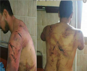 “شاهد” وحشية التعذيب الذي تعرض له الناشط “ابراهيم الجعدني” داخل سجن إماراتي في عدن (صور)