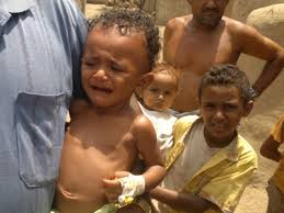 Yemeni Children Suffer Diverse Ailments Because of the Aggression
