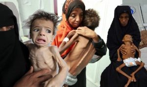 كيف تشارك السعودية والامارات في قتل أطفال اليمن ؟
