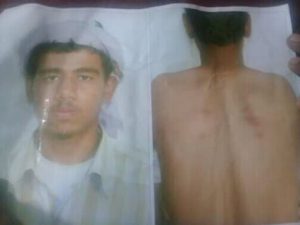 تعذيب مواطن35 ساعة في ادارة أمن بيحان على الطريقة الإماراتية (صورة) 