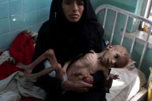 أين أنتم في يوم طفولتكم من أطفال اليمن ..؟!!