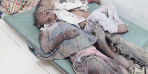 منظمة دولية تدق ناقوس الخطر.. “أنقذوا أطفال اليمن”!