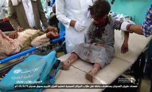 أكثر من100 شهيد وجريح في مذبحة مروعة للعدوان بحق أطفال صعدة