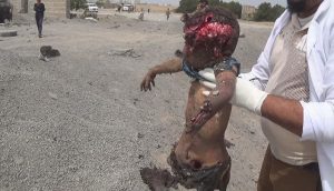 اليونيسف تكشف عن أكثر الهجمات دموية على الأطفال في اليمن